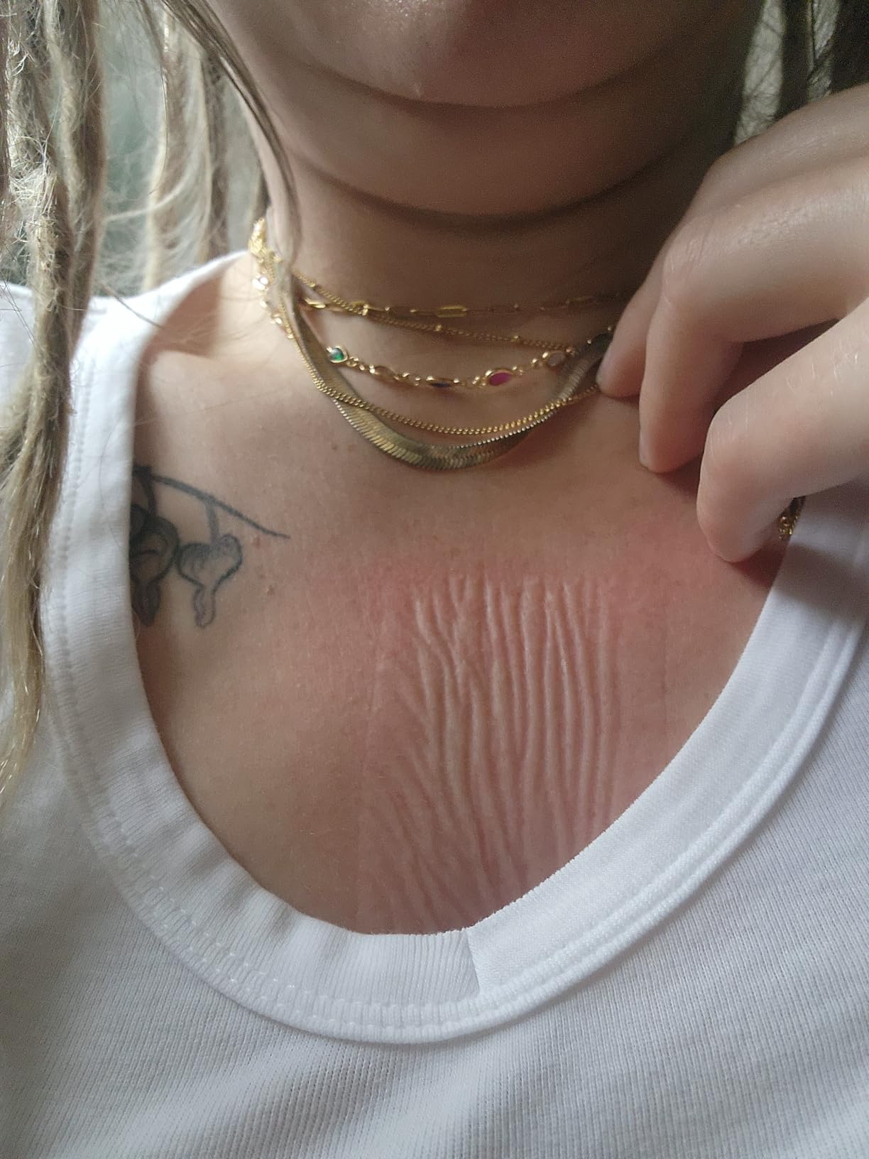 Dermayra Medical-Grade Hydrocolloid Roll