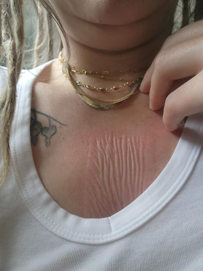 Dermayra Medical-Grade Hydrocolloid Roll