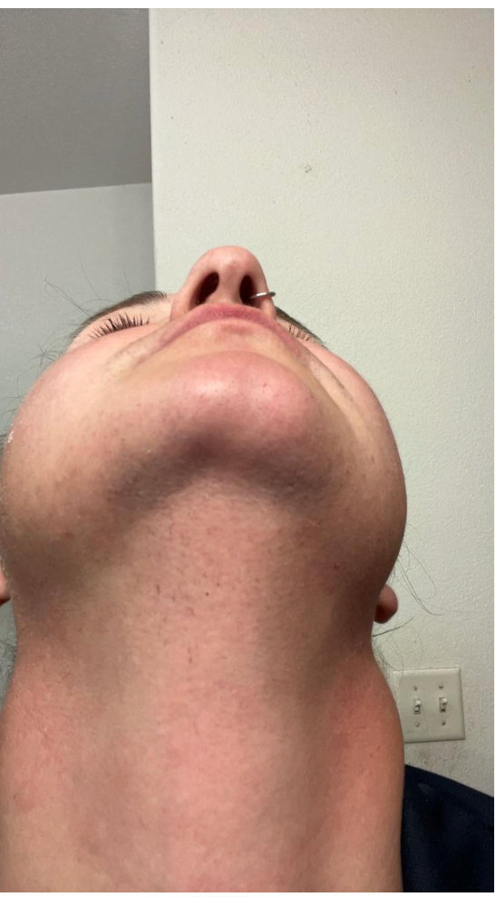 ShaveLess: Cyperus Rotundus Oil