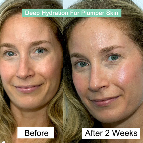 Dermayra Ultra-Hydrating Hyaluronic Acid Serum Kits