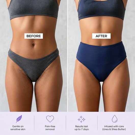 SmoothSkin: Hair Removal Kit